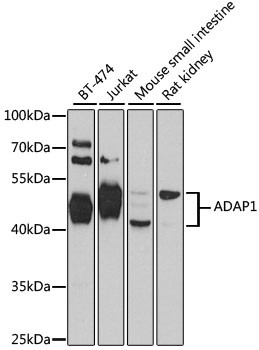 Centaurin alpha-1 Antibody in Western Blot (WB)