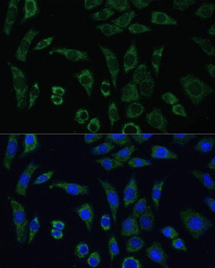 AEBP1 Antibody in Immunocytochemistry (ICC/IF)