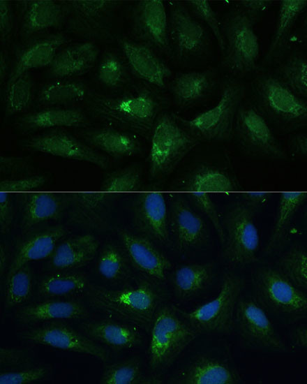 AEBP1 Antibody in Immunocytochemistry (ICC/IF)