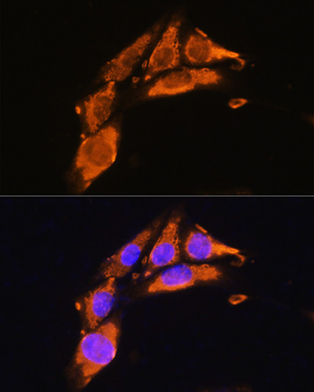 Agrin Antibody in Immunocytochemistry (ICC/IF)