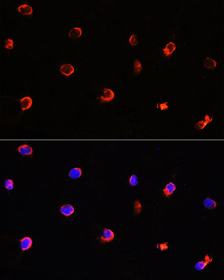 AIPL1 Antibody in Immunocytochemistry (ICC/IF)