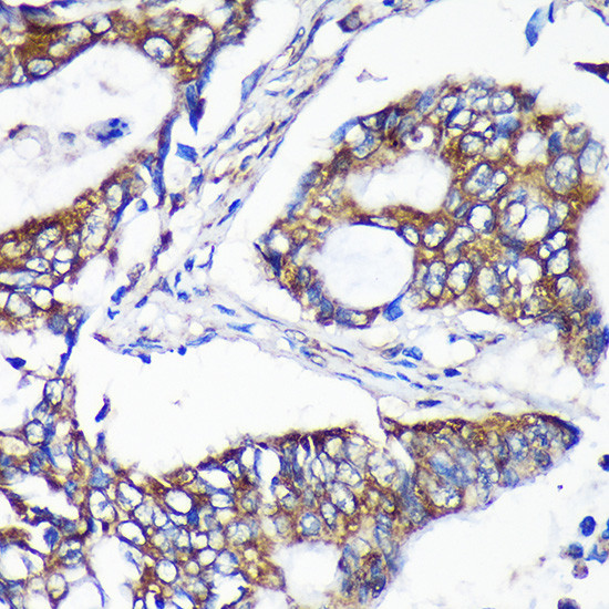 ALG5 Antibody in Immunohistochemistry (Paraffin) (IHC (P))