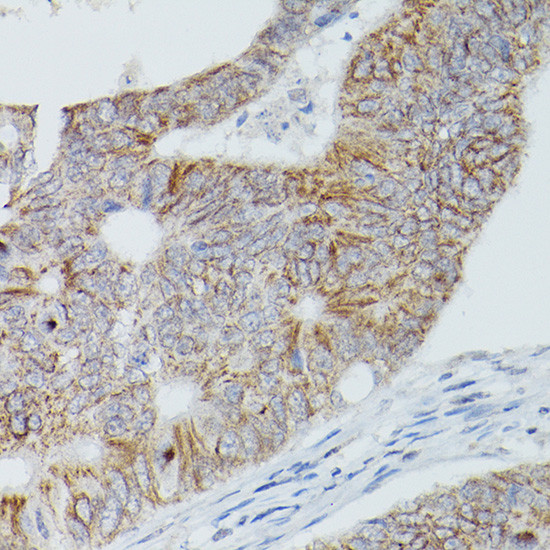 ALPL Antibody in Immunohistochemistry (Paraffin) (IHC (P))