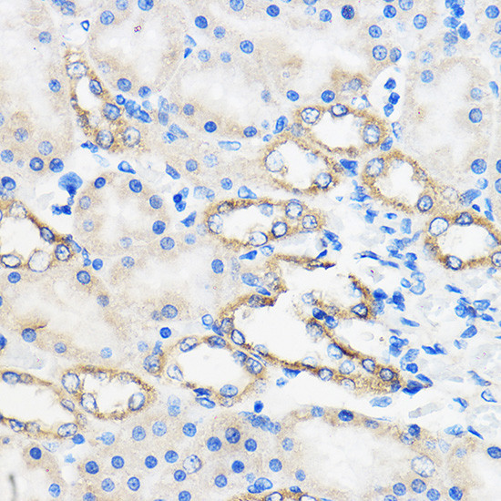 ANT1/ANT2/ANT3/ANT4 Antibody in Immunohistochemistry (Paraffin) (IHC (P))