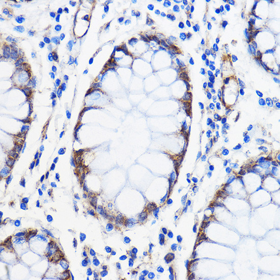 ANT1/ANT2/ANT3/ANT4 Antibody in Immunohistochemistry (Paraffin) (IHC (P))