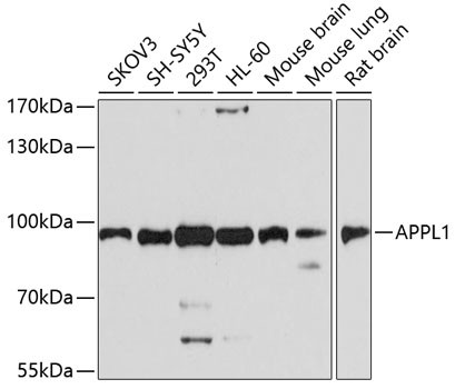 APPL1 Antibody in Western Blot (WB)