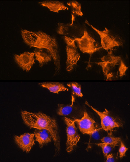 ARF4 Antibody in Immunocytochemistry (ICC/IF)