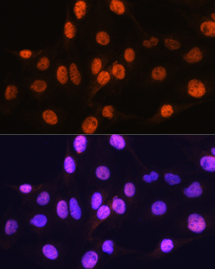 ARX Antibody in Immunocytochemistry (ICC/IF)