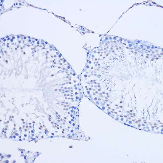 ARX Antibody in Immunohistochemistry (Paraffin) (IHC (P))