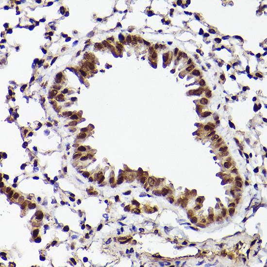 ATF5 Antibody in Immunohistochemistry (Paraffin) (IHC (P))