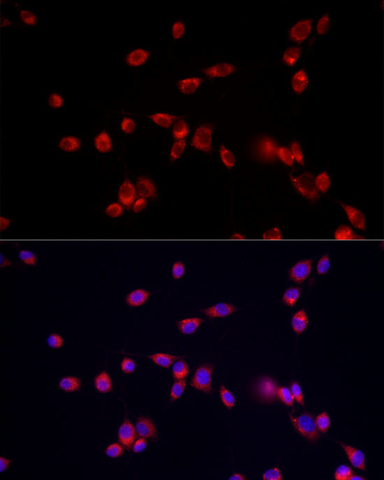 ATP13A2 Antibody in Immunocytochemistry (ICC/IF)