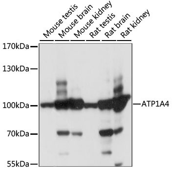 ATP1A4 Antibody in Western Blot (WB)