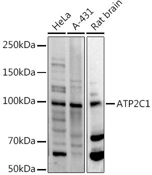 ATP2C1 Antibody in Western Blot (WB)