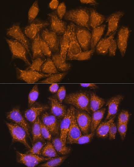 ATP6V1E1 Antibody in Immunocytochemistry (ICC/IF)