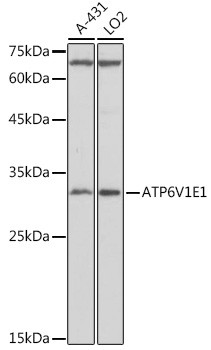 ATP6V1E1 Antibody in Western Blot (WB)