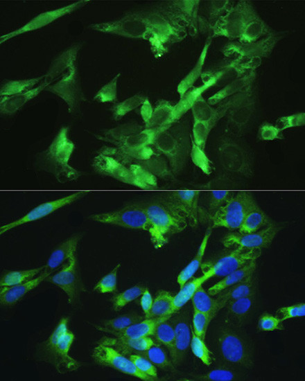 BMPR2 Antibody in Immunocytochemistry (ICC/IF)