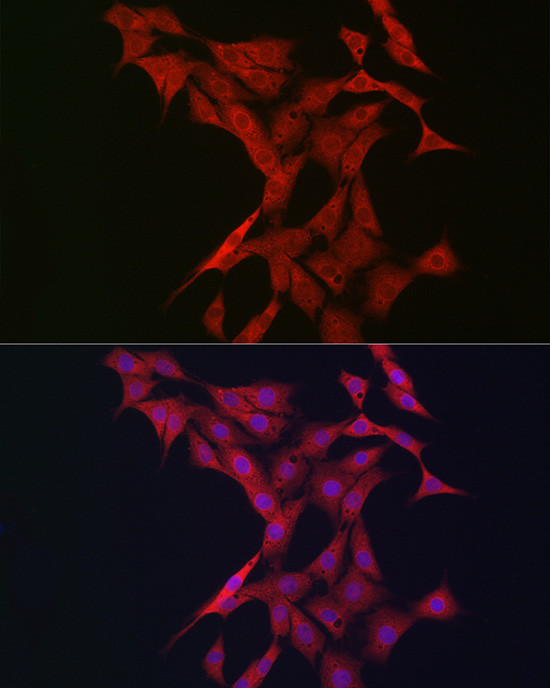 BTRC Antibody in Immunocytochemistry (ICC/IF)