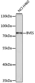 BVES Antibody in Western Blot (WB)