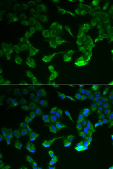 C1r Antibody in Immunocytochemistry (ICC/IF)