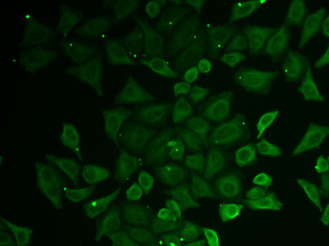 KNP-I Antibody in Immunocytochemistry (ICC/IF)