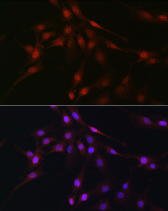 C9orf72 Antibody in Immunocytochemistry (ICC/IF)