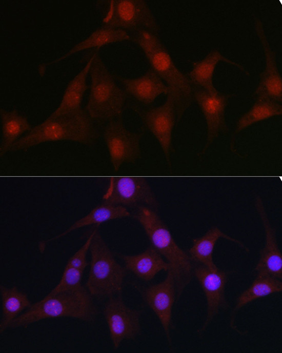 C9orf72 Antibody in Immunocytochemistry (ICC/IF)