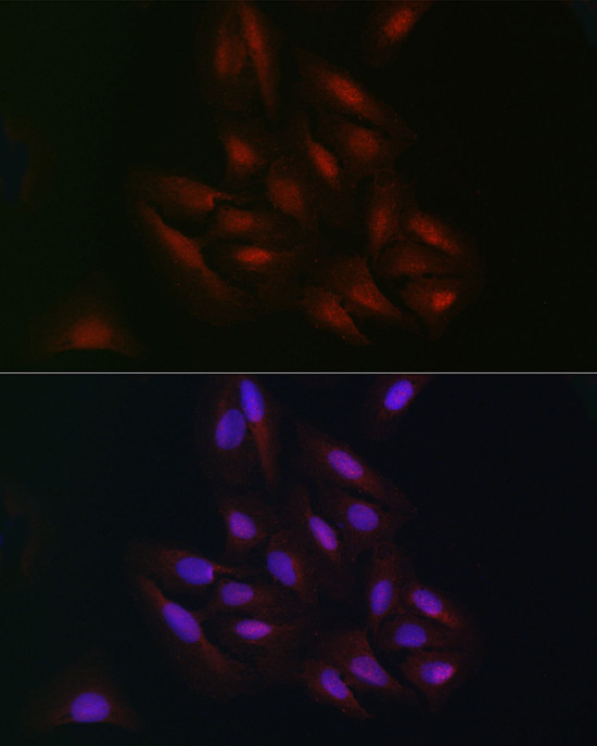 C9orf72 Antibody in Immunocytochemistry (ICC/IF)