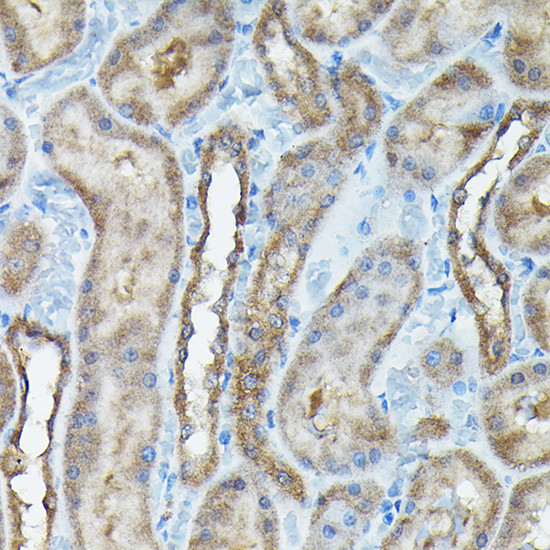 C9orf72 Antibody in Immunohistochemistry (Paraffin) (IHC (P))