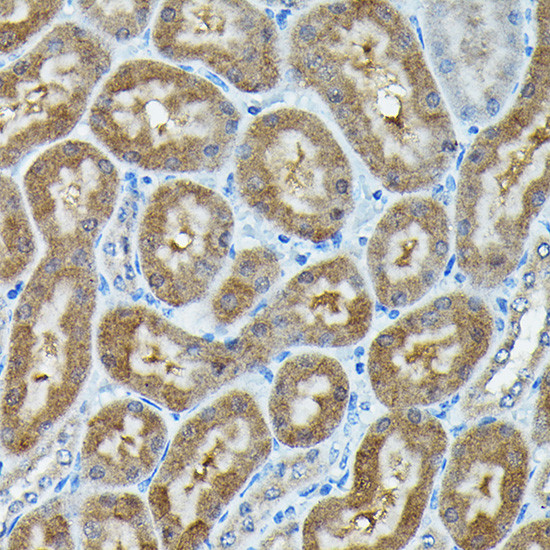 C9orf72 Antibody in Immunohistochemistry (Paraffin) (IHC (P))