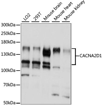 CACNA2D1 Antibody in Western Blot (WB)