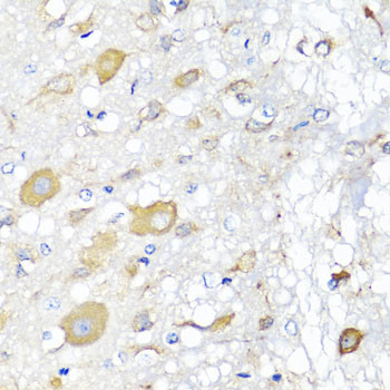 CALHM1 Antibody in Immunohistochemistry (Paraffin) (IHC (P))