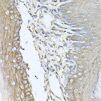 CALU Antibody in Immunohistochemistry (Paraffin) (IHC (P))