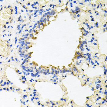 CALU Antibody in Immunohistochemistry (Paraffin) (IHC (P))