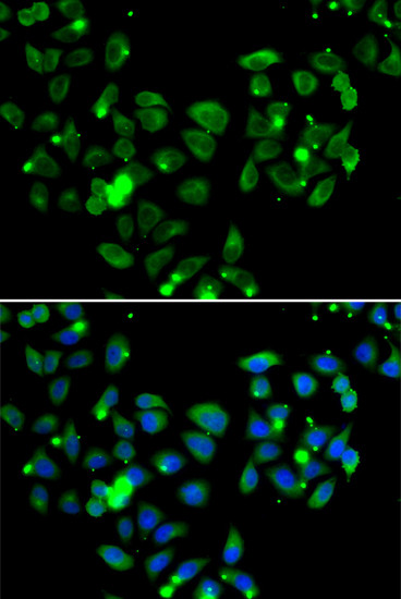 CARD11 Antibody in Immunocytochemistry (ICC/IF)