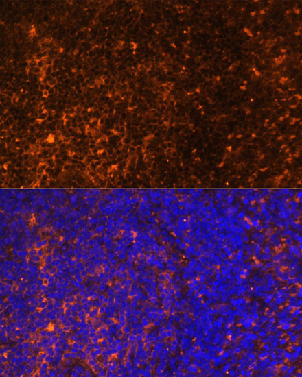 CCL19 Antibody in Immunohistochemistry (Paraffin) (IHC (P))