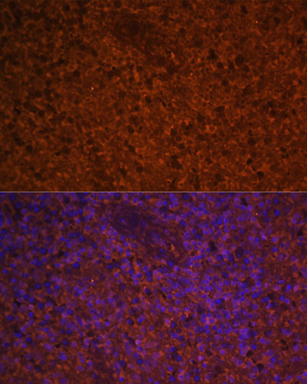 CCL19 Antibody in Immunohistochemistry (Paraffin) (IHC (P))