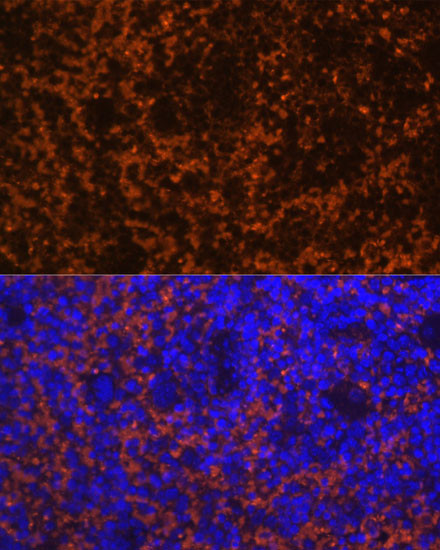 CCL19 Antibody in Immunohistochemistry (Paraffin) (IHC (P))