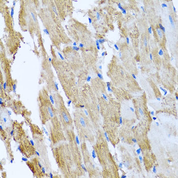 CCM2 Antibody in Immunohistochemistry (Paraffin) (IHC (P))