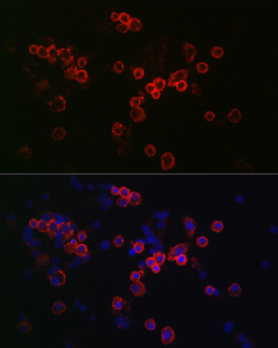 CCR7 Antibody in Immunocytochemistry (ICC/IF)