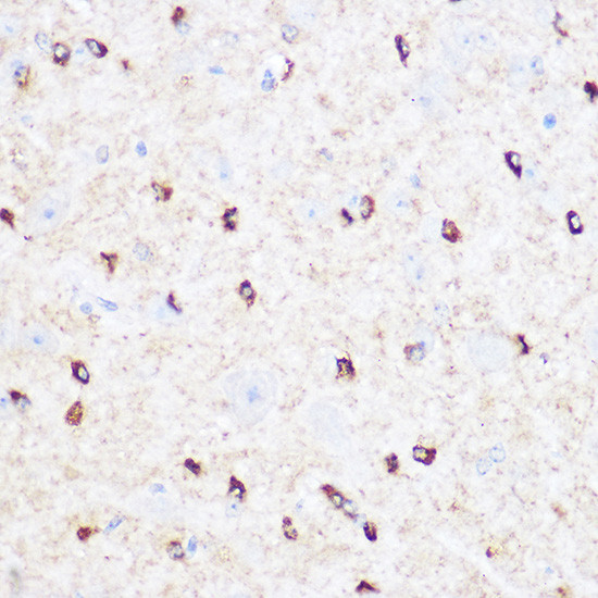 CD47 Antibody in Immunohistochemistry (Paraffin) (IHC (P))