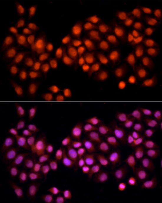 Cdc25A Antibody in Immunocytochemistry (ICC/IF)