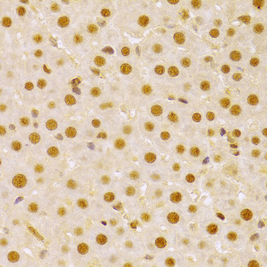 Cdc25A Antibody in Immunohistochemistry (Paraffin) (IHC (P))