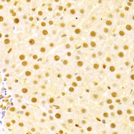 Cdc25A Antibody in Immunohistochemistry (Paraffin) (IHC (P))