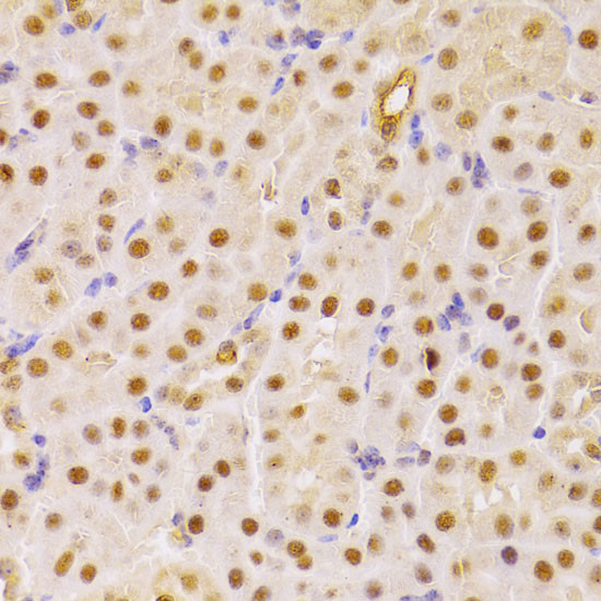 Cdc25A Antibody in Immunohistochemistry (Paraffin) (IHC (P))