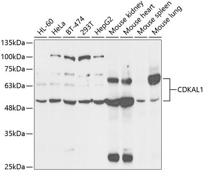 CDKAL1 Antibody in Western Blot (WB)