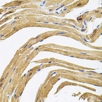 CEP164 Antibody in Immunohistochemistry (Paraffin) (IHC (P))