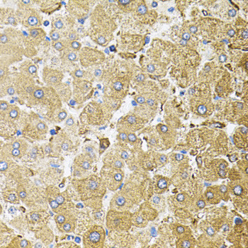 CEP164 Antibody in Immunohistochemistry (Paraffin) (IHC (P))