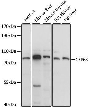 CEP63 Antibody in Western Blot (WB)