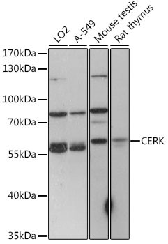 CERK Antibody in Western Blot (WB)