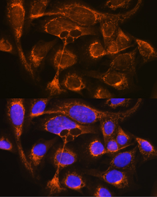 Properdin Antibody in Immunocytochemistry (ICC/IF)